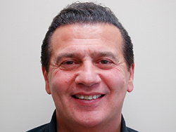 Crooked smile before Invisalign